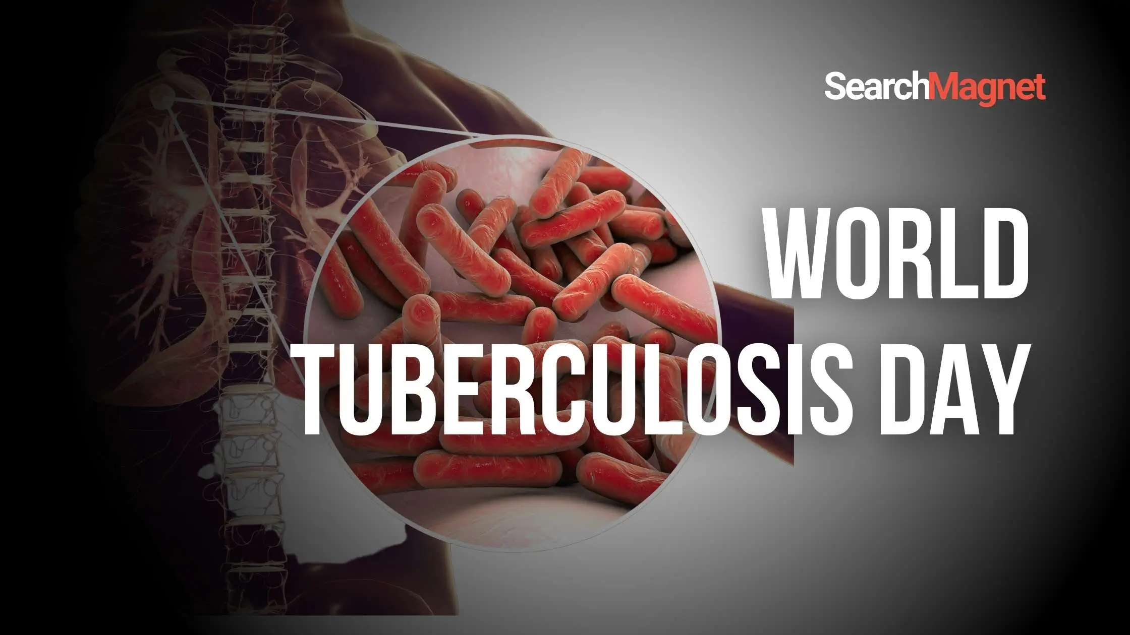 World Tuberculosis Day